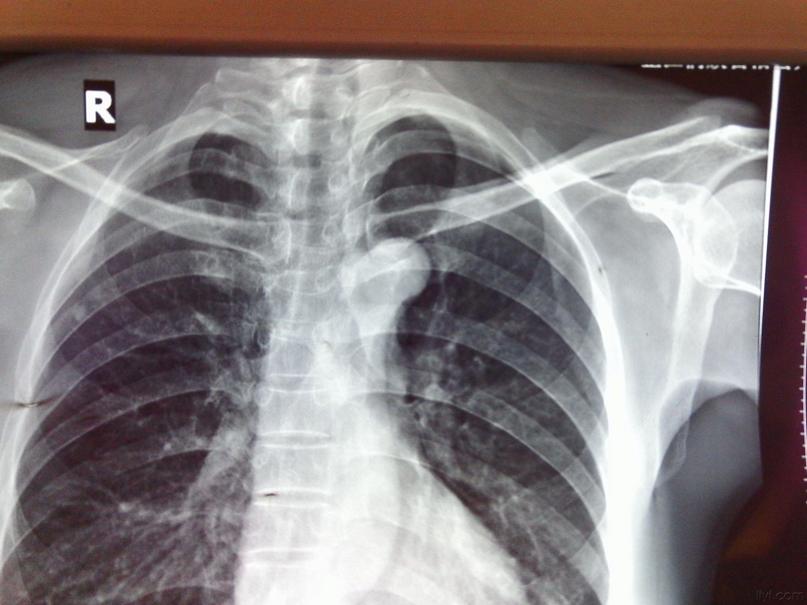 这是县人民医院的照片