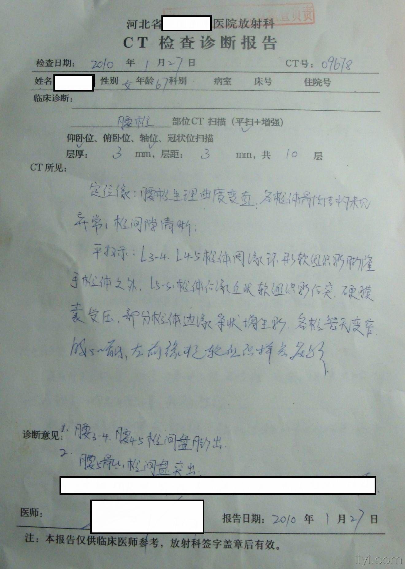 女,67岁,腰及右侧下肢疼痛,无力