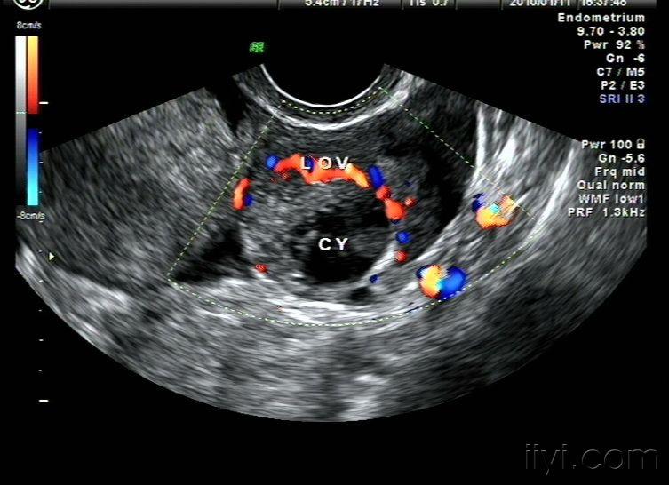 还是黄体图片(再谈黄体) - 超声医学讨论版 - 爱爱医医学论坛