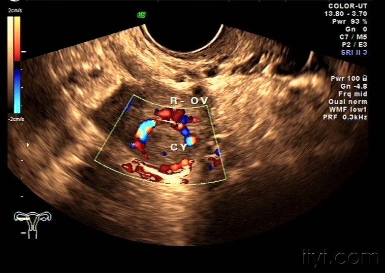 还是黄体图片(再谈黄体) - 超声医学讨论版 - 爱爱医医学论坛