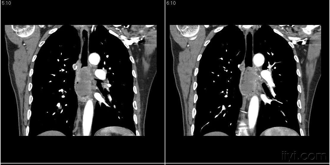 男人怎么减肚子和腰 1004281140118a5919fa226804.jpg