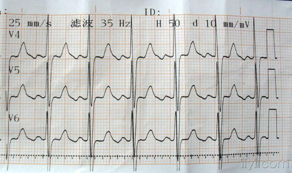 心电图脑电图专业讨论版 - 爱爱医医学论坛