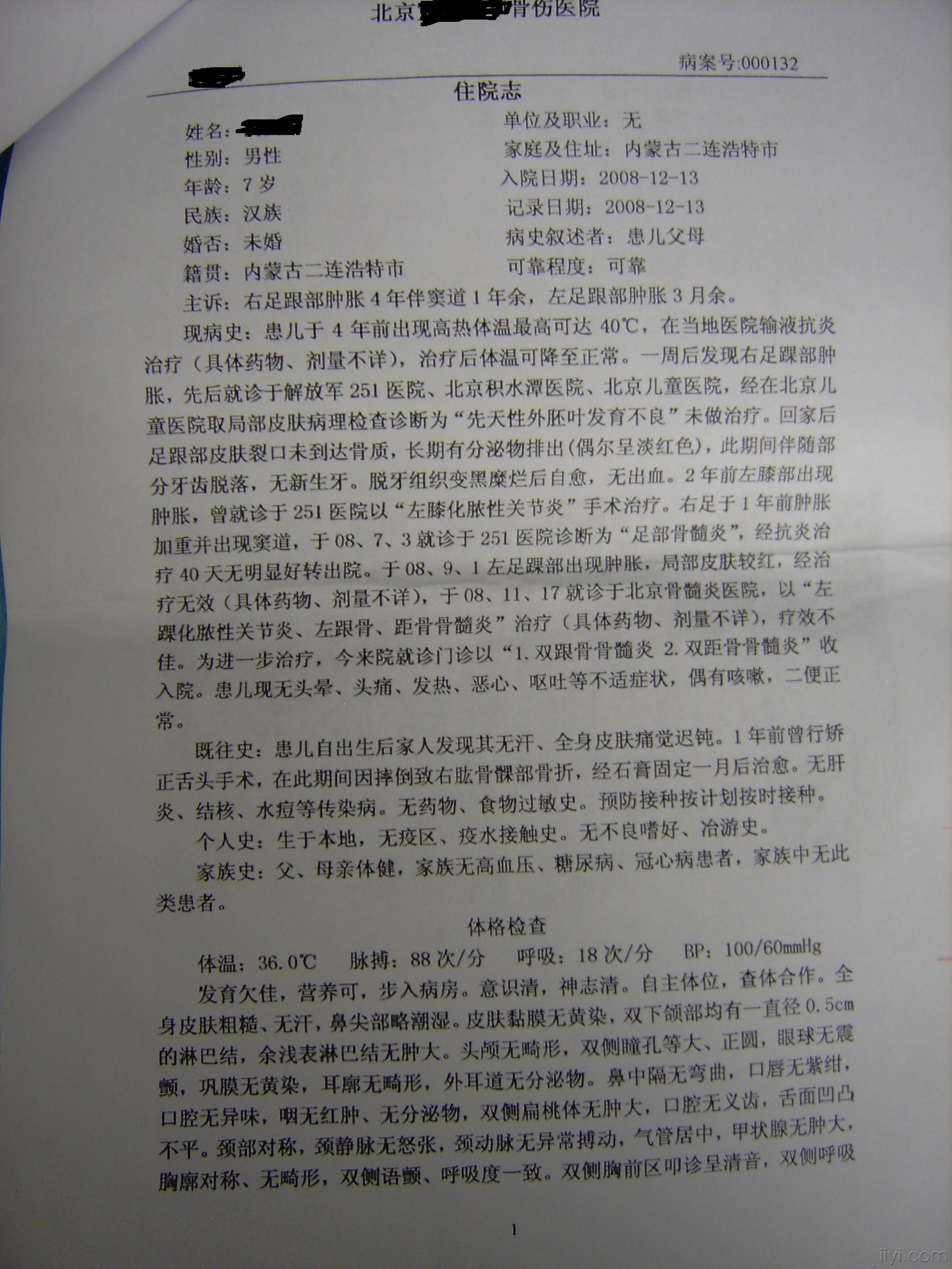 看图说话201002先天性外胚叶发育不良