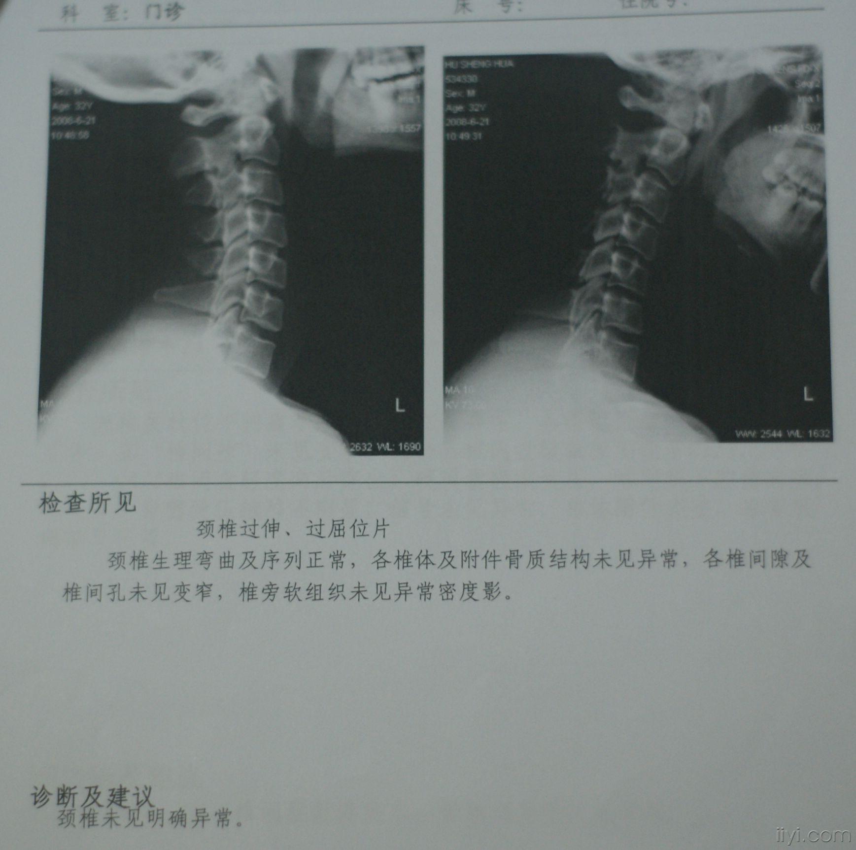16年颈椎病请求讨论病因
