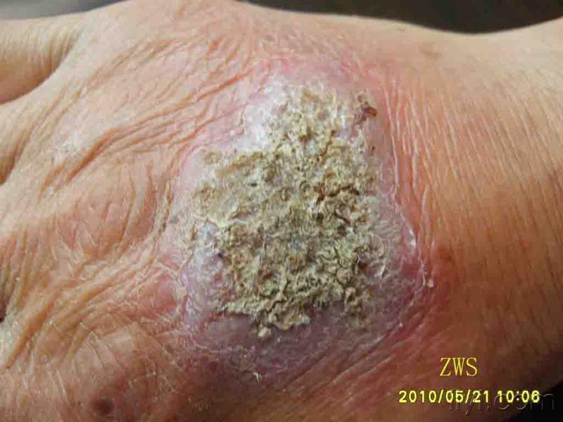 病例讨论请你诊断