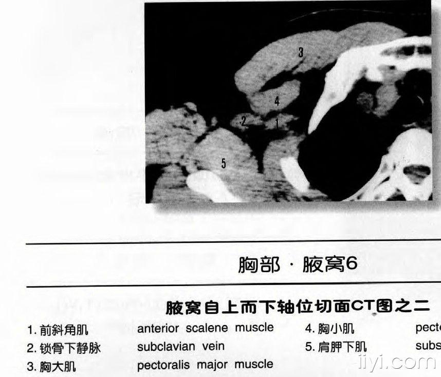 腋窝ct解剖图片