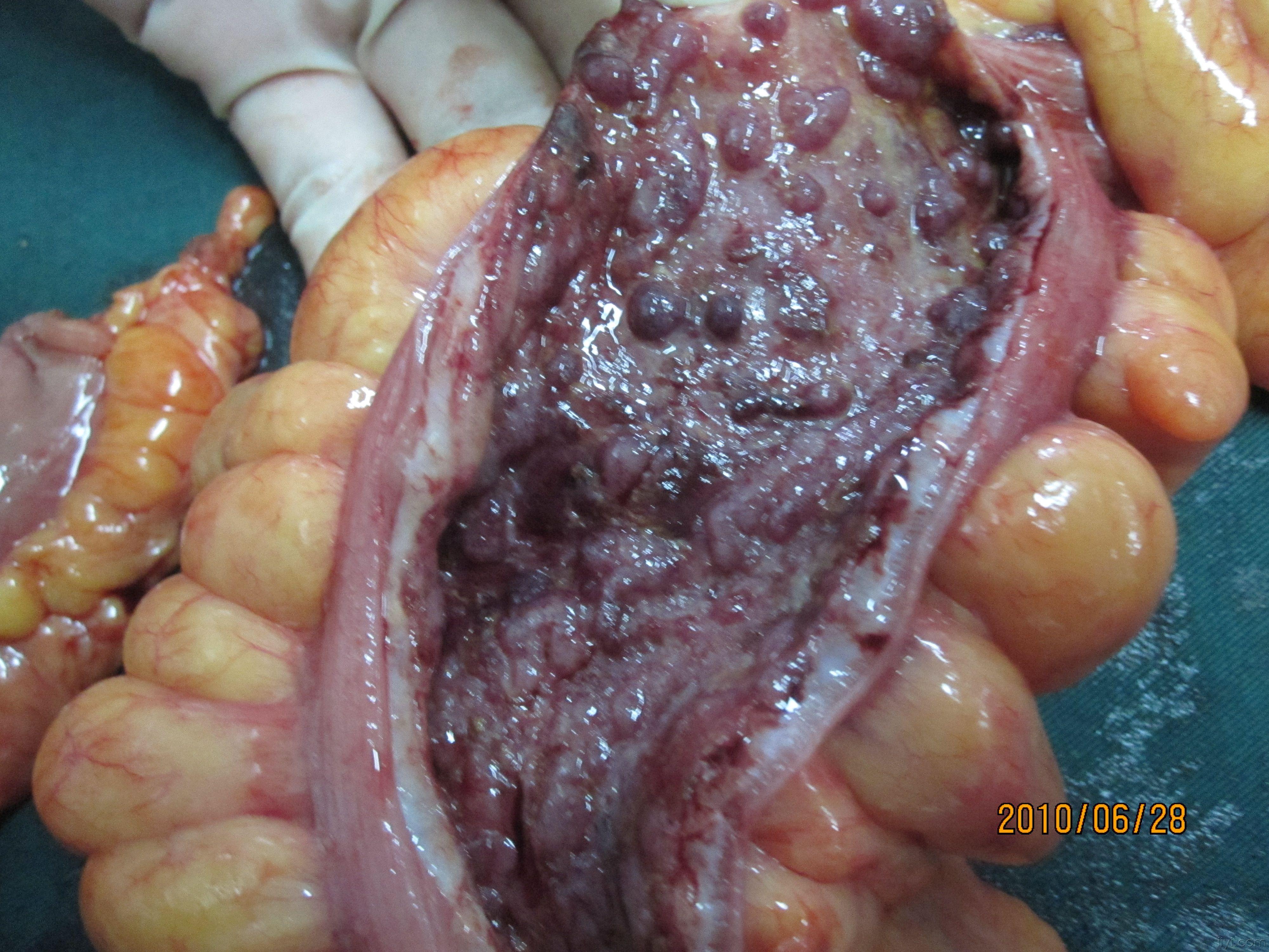 剖女人的肚子看肠子图片