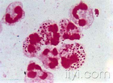 求清晰的革兰染色淋球菌图片