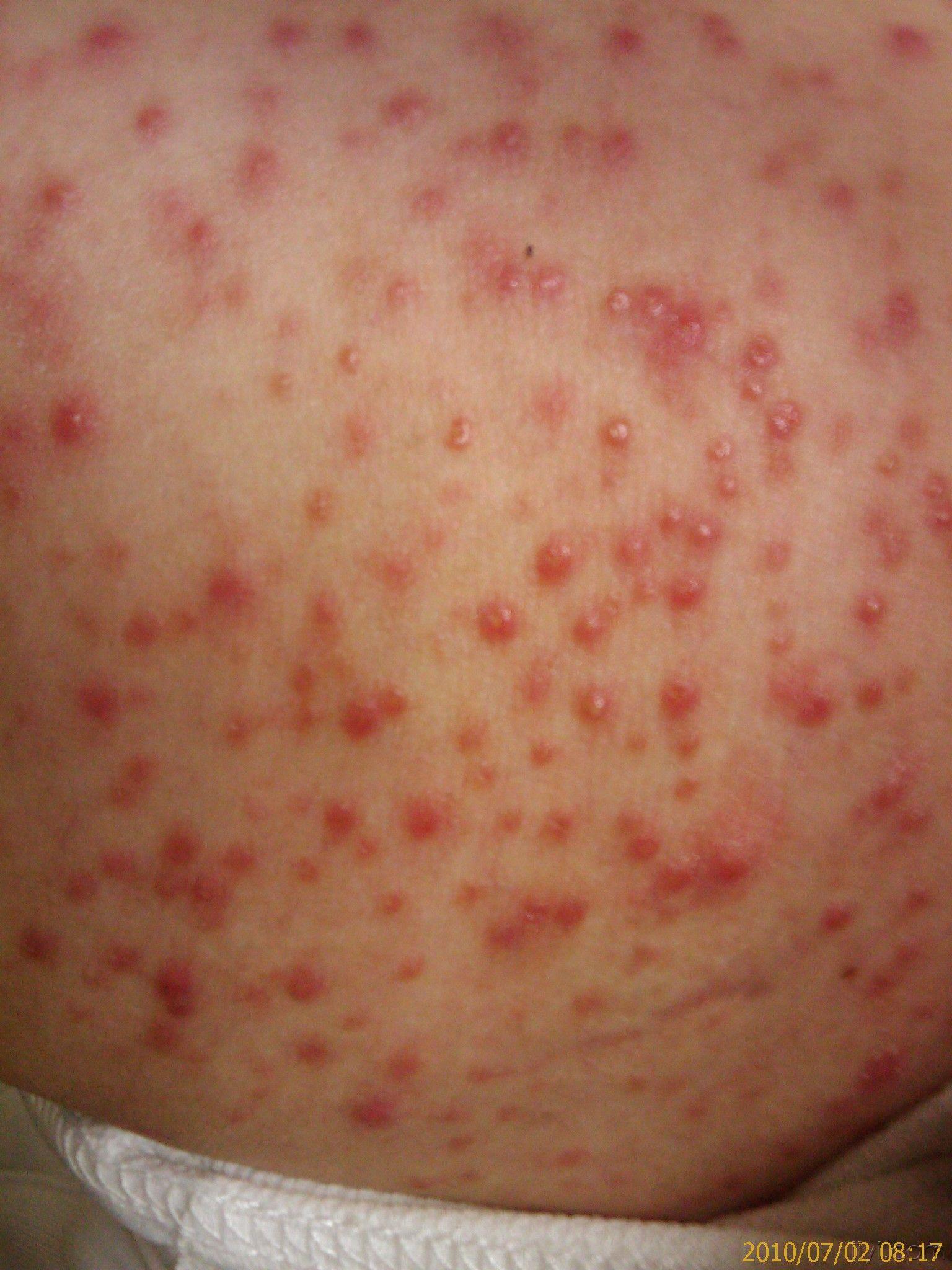 看图诊病高人接招1