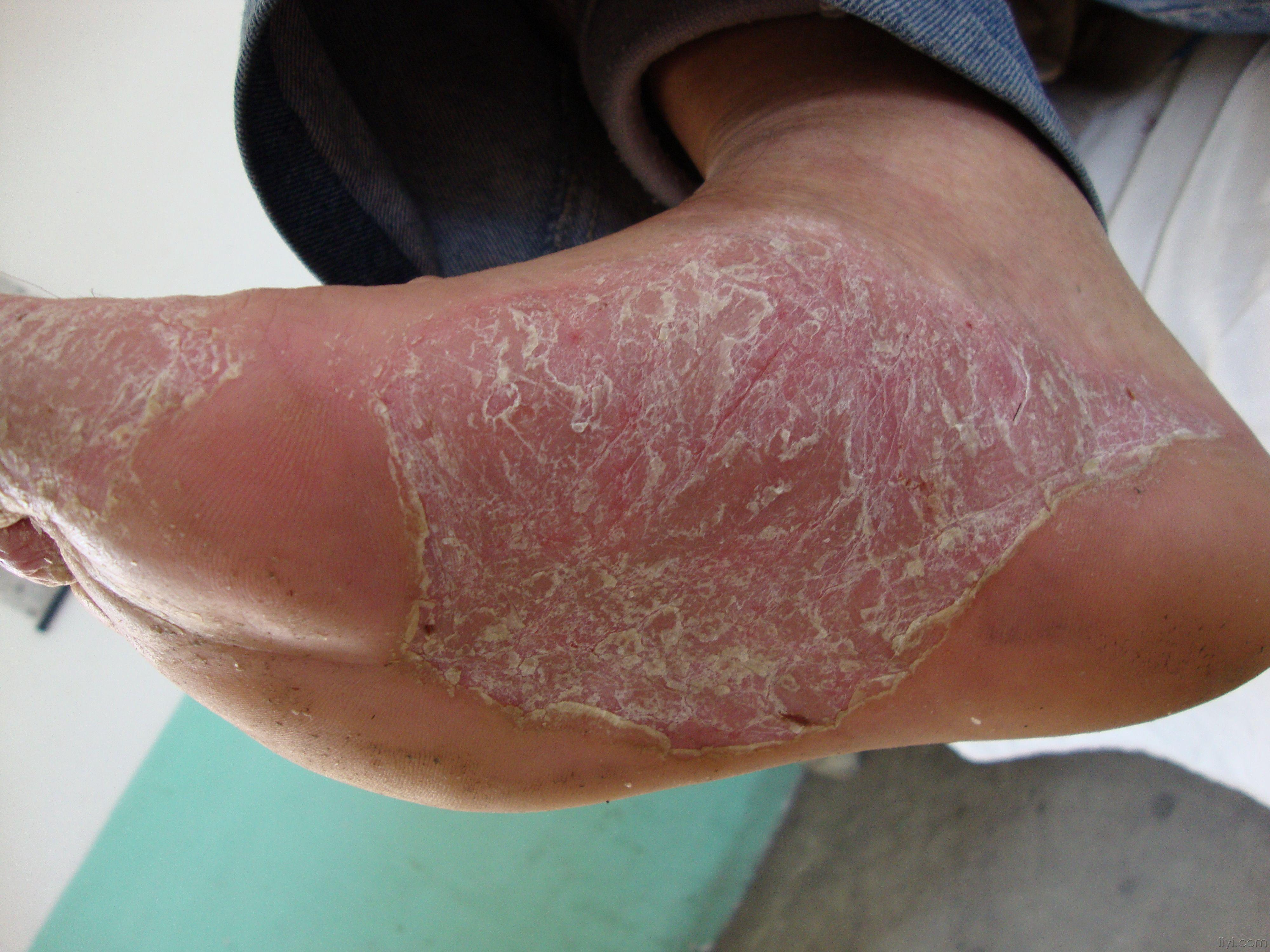 有图有真相什么病