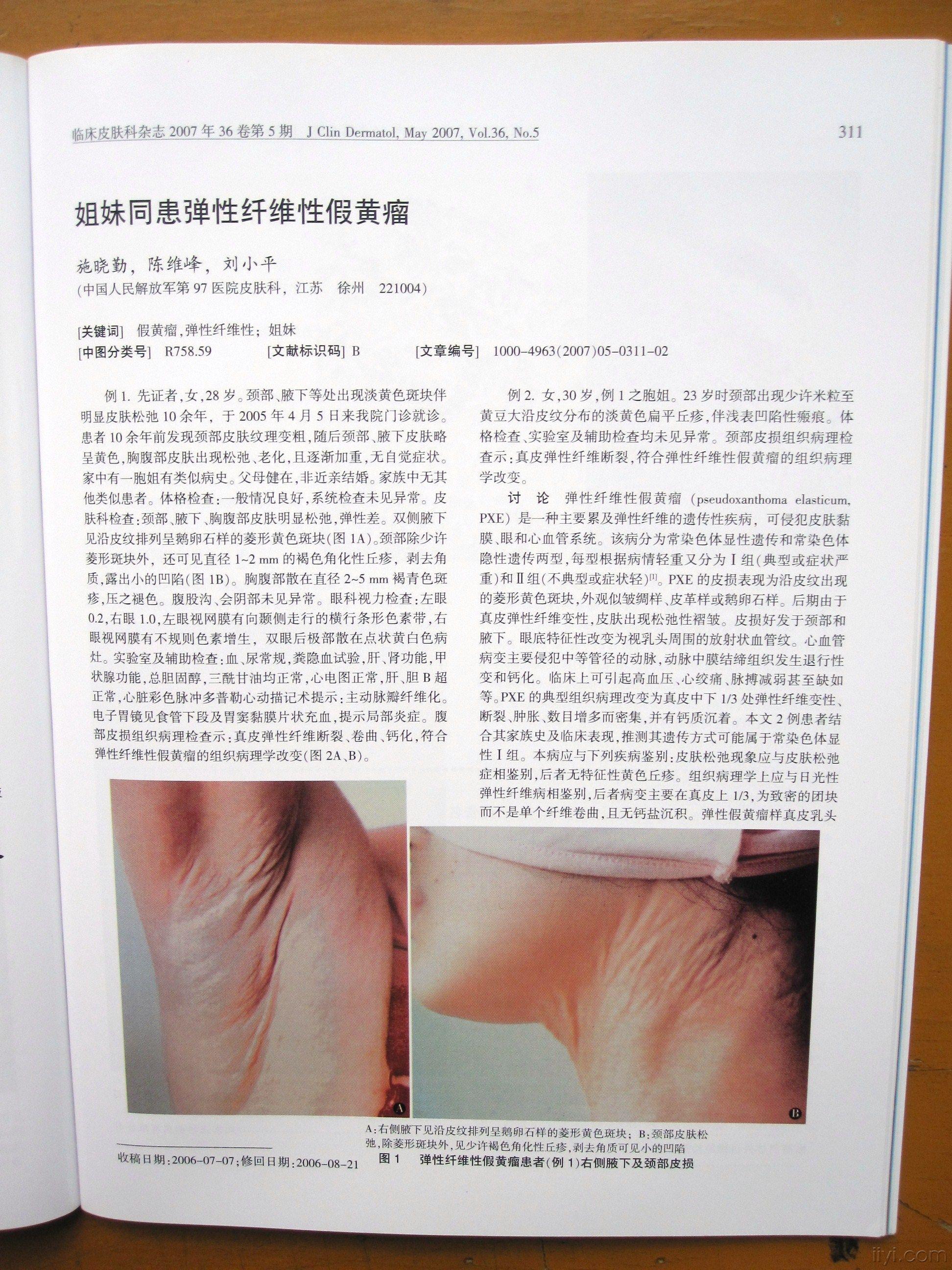 请教高手什么病