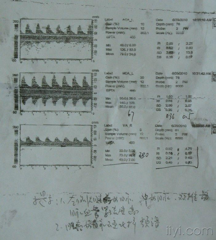 帮忙分析一下这张tcd报告单