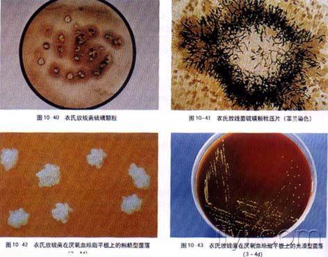 放线菌的菌落图片