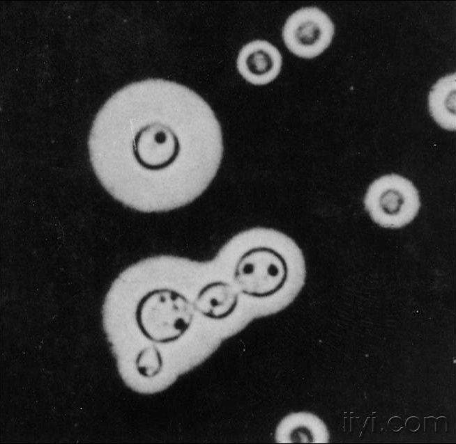隐球菌结构图片