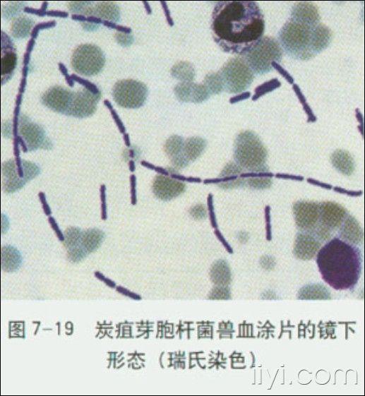 胶孢炭疽菌形态图图片