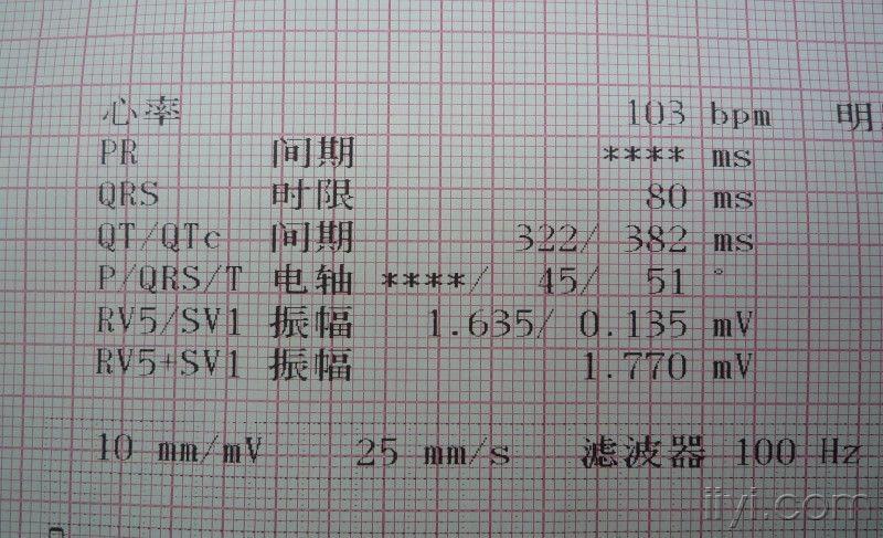 心慌简谱_月光光心慌慌简谱(2)