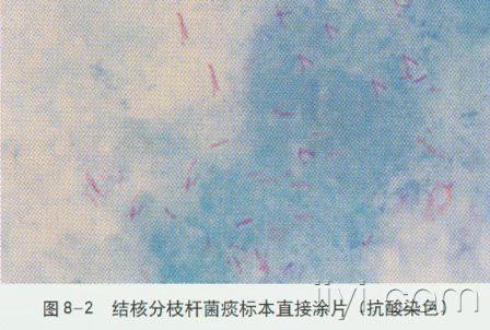 痰涂片抗酸染色步骤图片