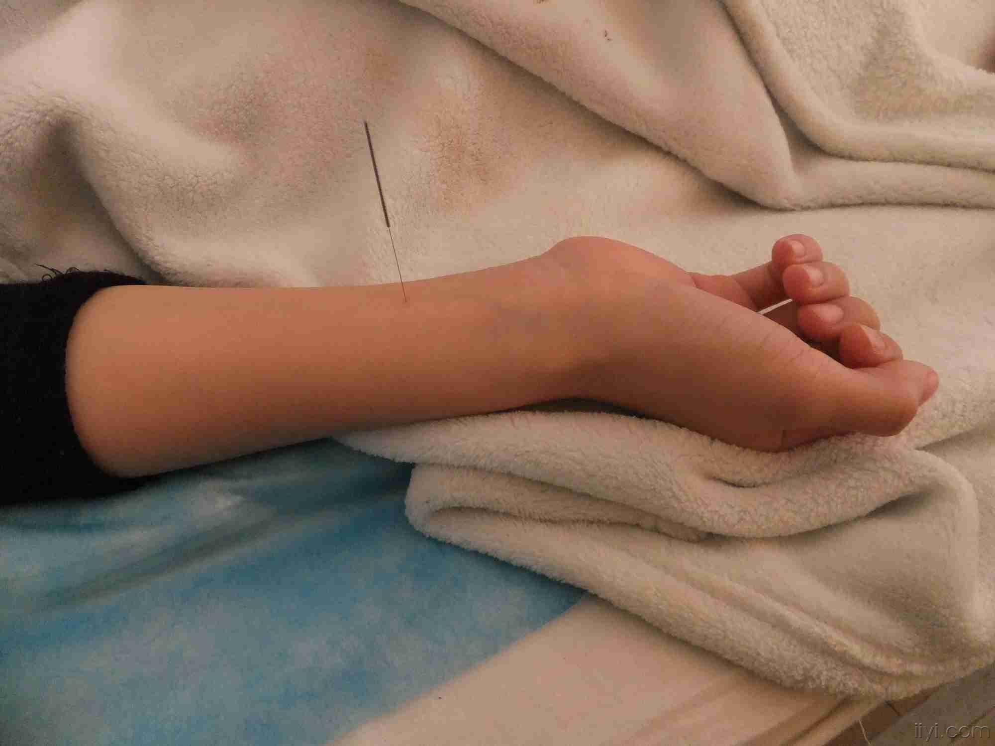 雪儿学针灸--------针内关后呕吐粘糊糊液体