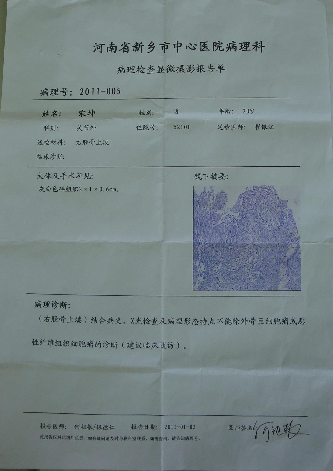 一个骨肿瘤病例请大家多提宝贵意见