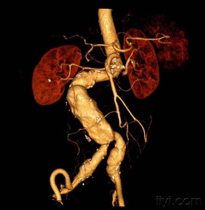 典型病例的三维重建(1072997) - 医学影像学讨论版 - 爱爱医医学论坛