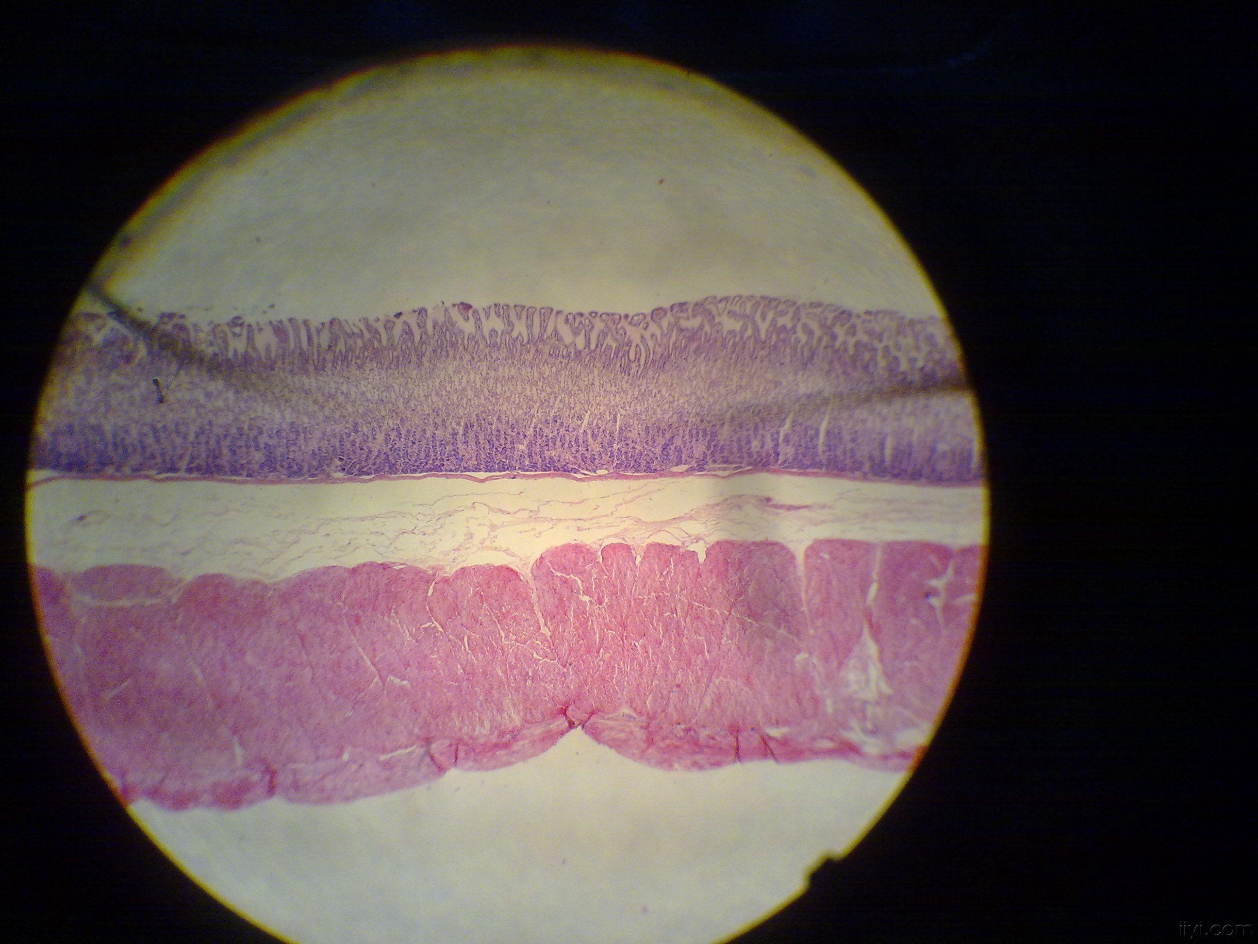 胃的组织切片图图片