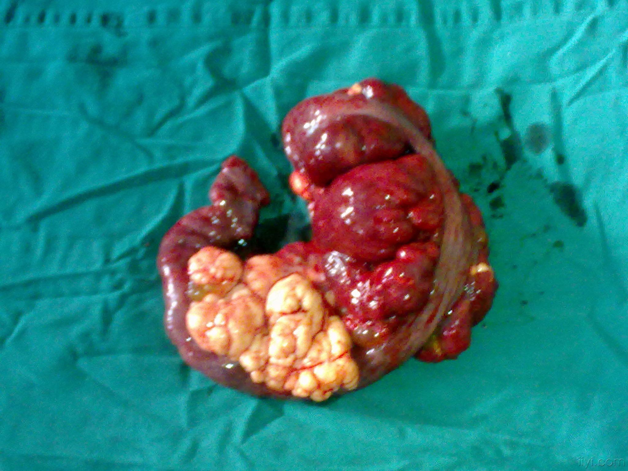 奇怪的肿物大家谁见过