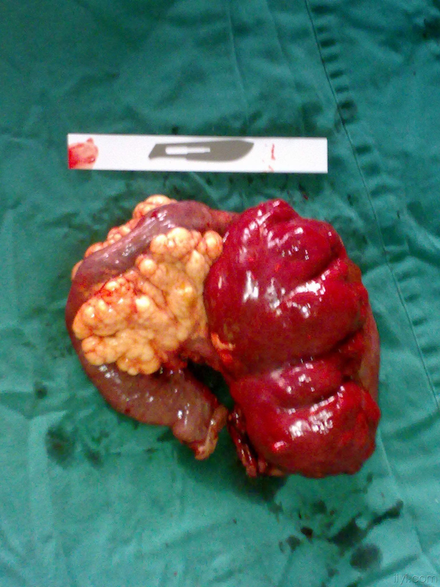 奇怪的肿物大家谁见过