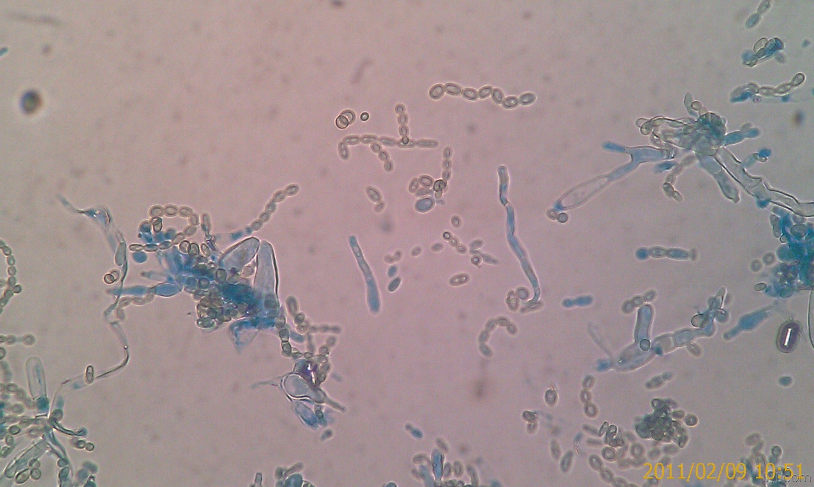 显微镜真菌孢子图片图片