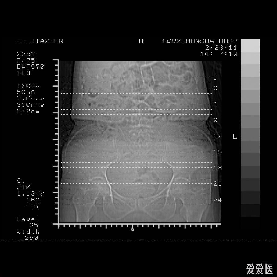 ct检查每个部位定位线图片