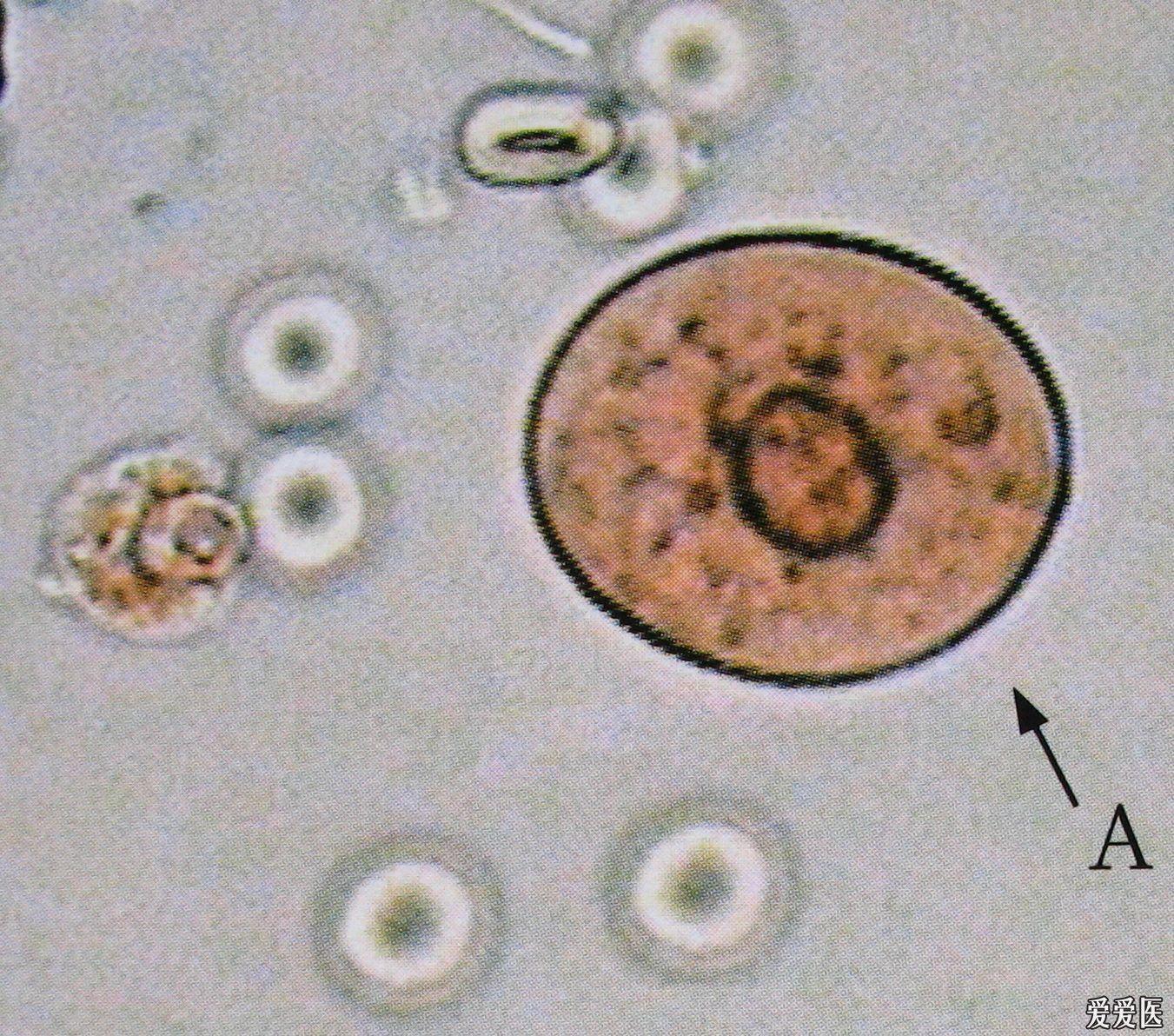 尿复粒细胞图片图片
