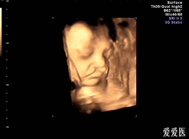 胎儿28周图片