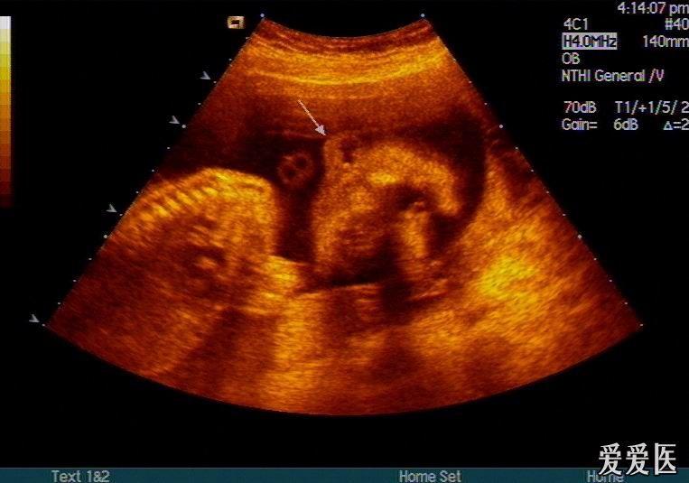 15特别贴:曾经删掉的帖子,再次奉献上图片——zengerya