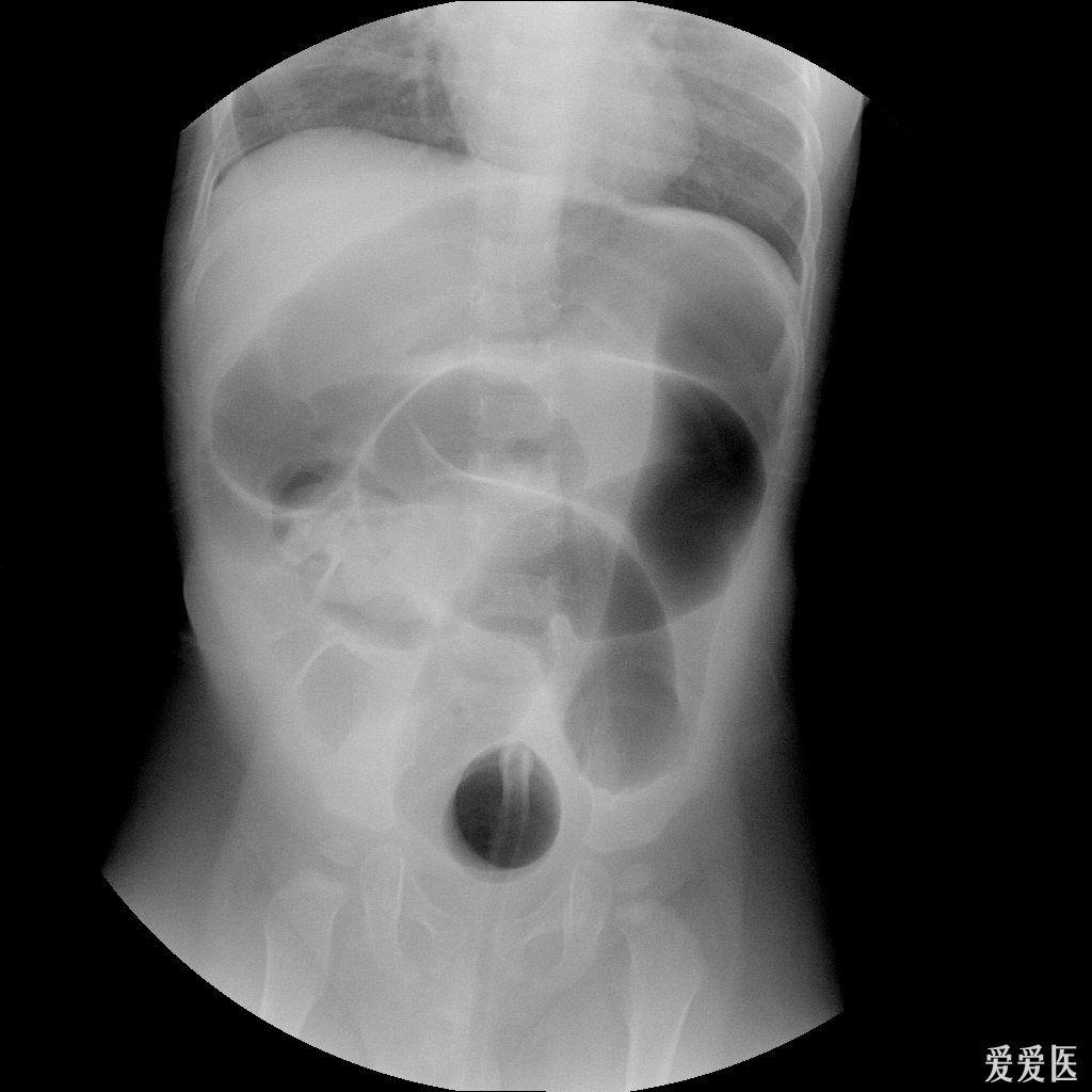 犬肠套叠x光影像图片图片