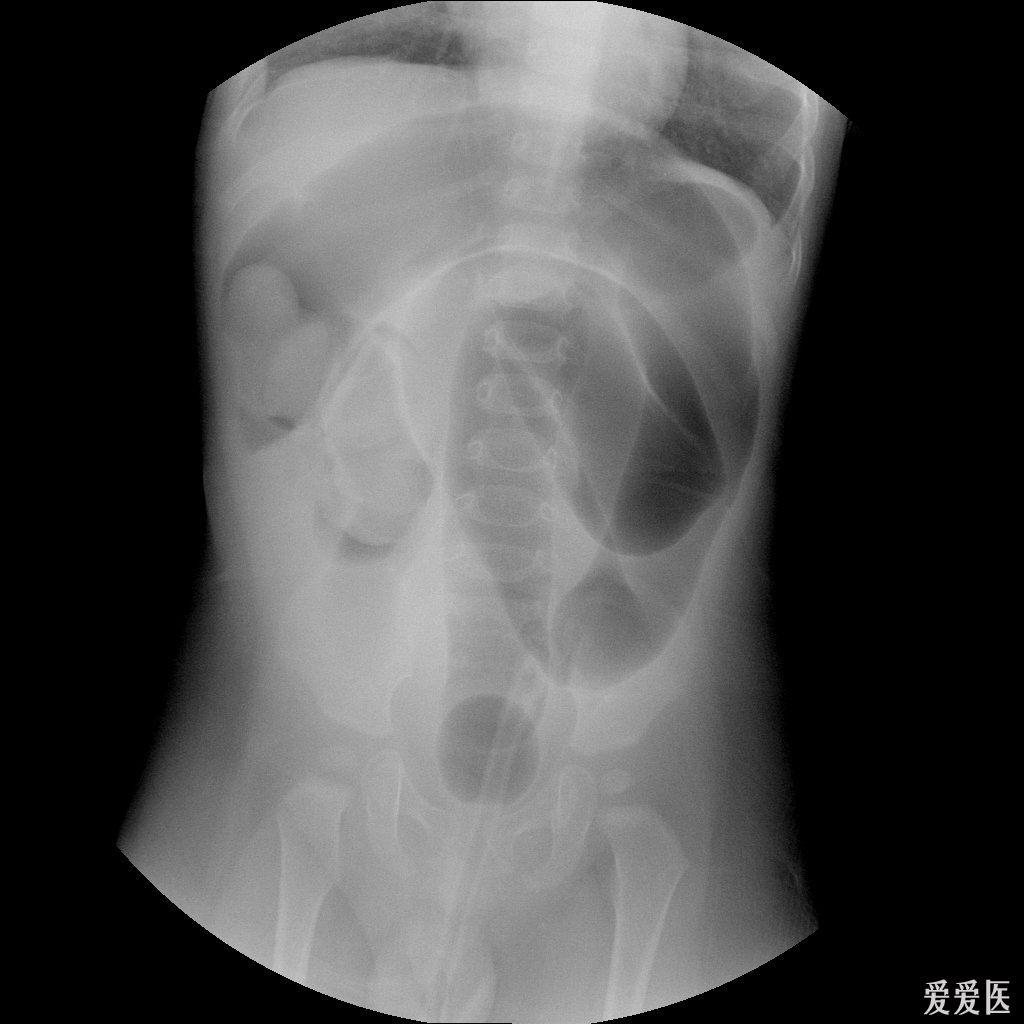 犬肠套叠x光影像图片图片