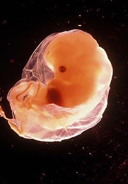 怀孕15天的胚胎图片图片