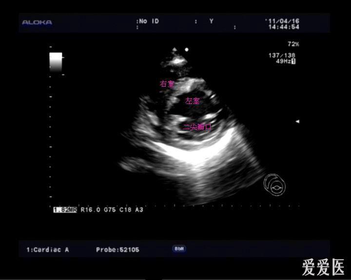 复习常用心脏切面 - 超声医学讨论版 - 爱爱医医学论坛