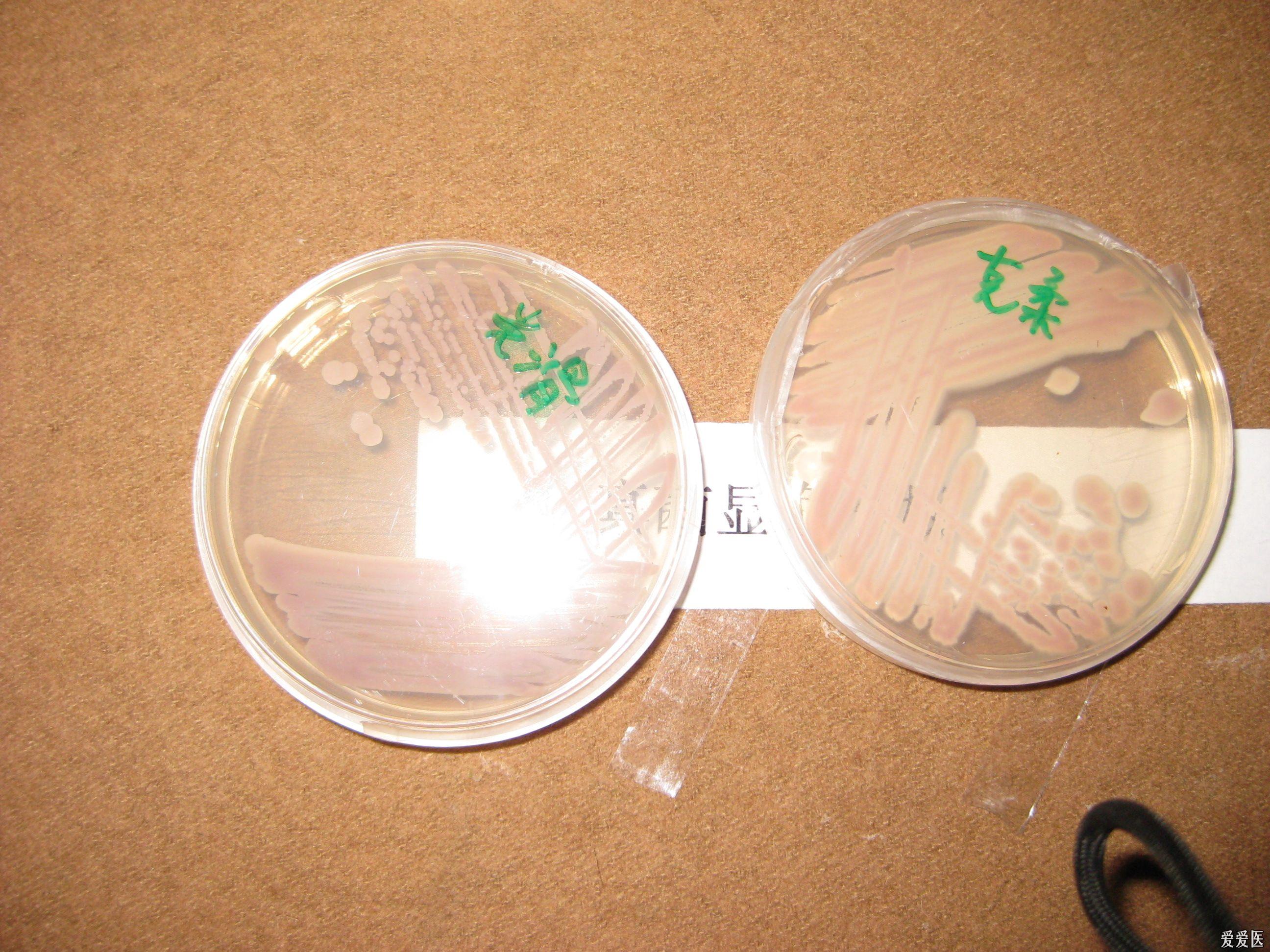 光滑与克柔氏念珠菌在念珠菌显色平板上的图片