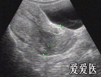 1105032207131adec94fdfc6bd.jpg
