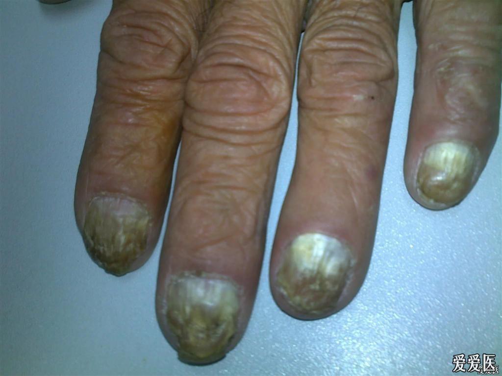 甲病下次请调整图片大小良版59