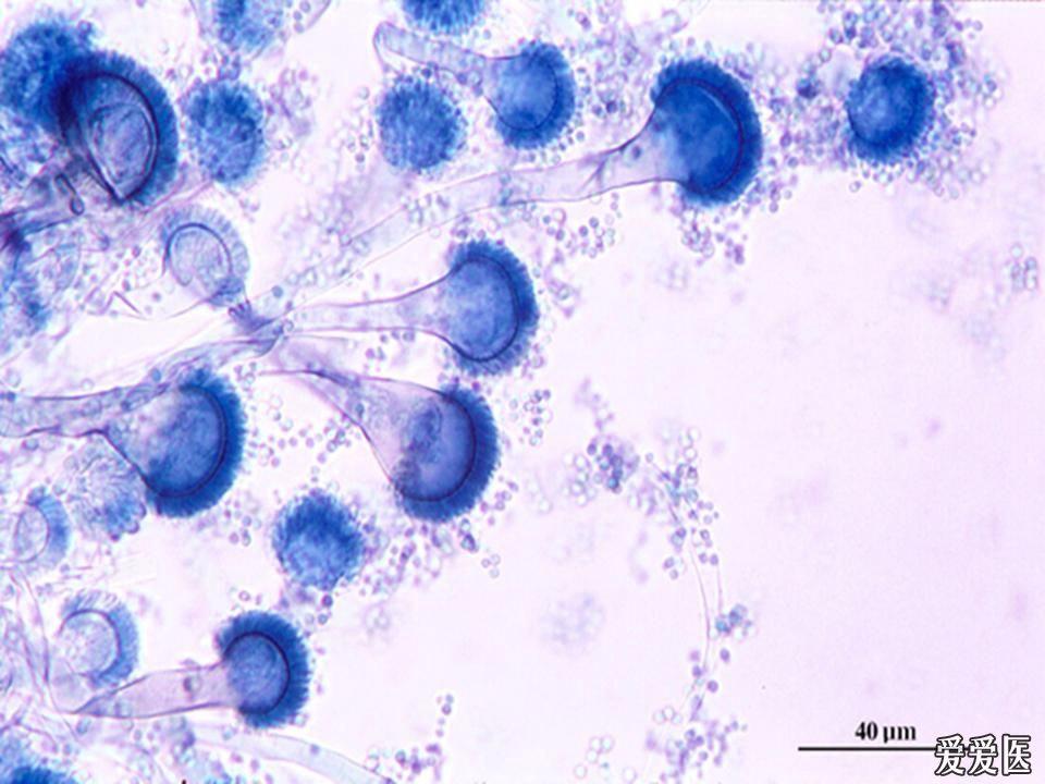 曲霉菌形状图片