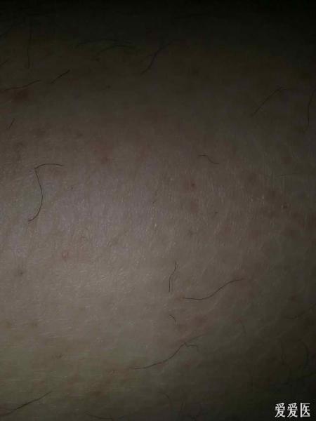 右侧腿部（曝光不好，看侧边）