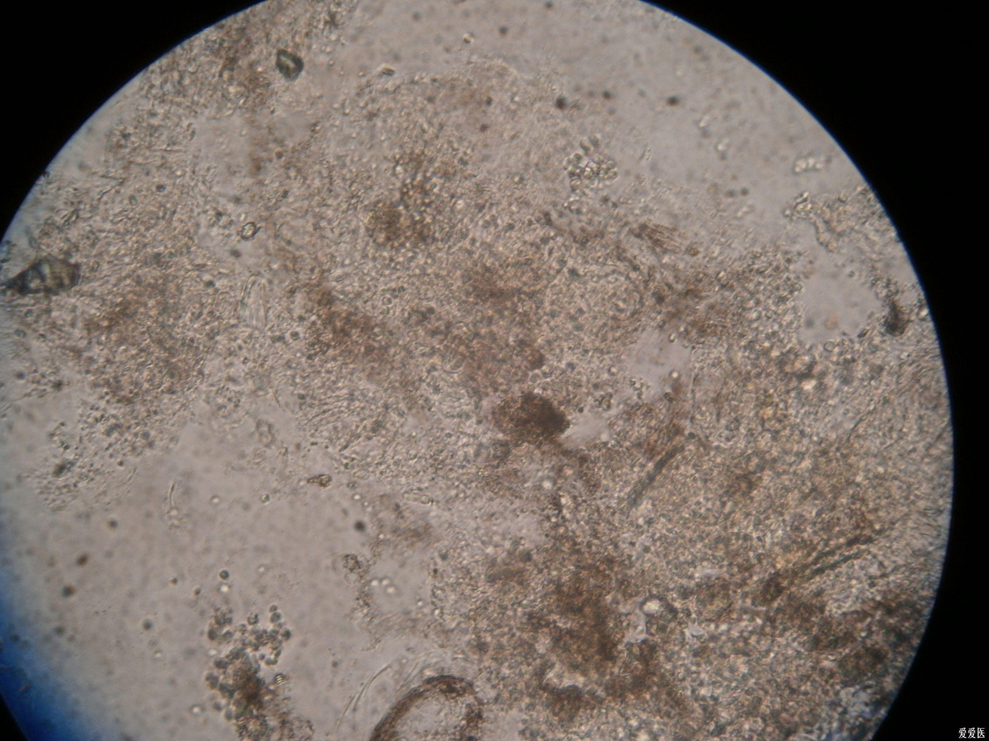 小分生孢子显微镜图片图片