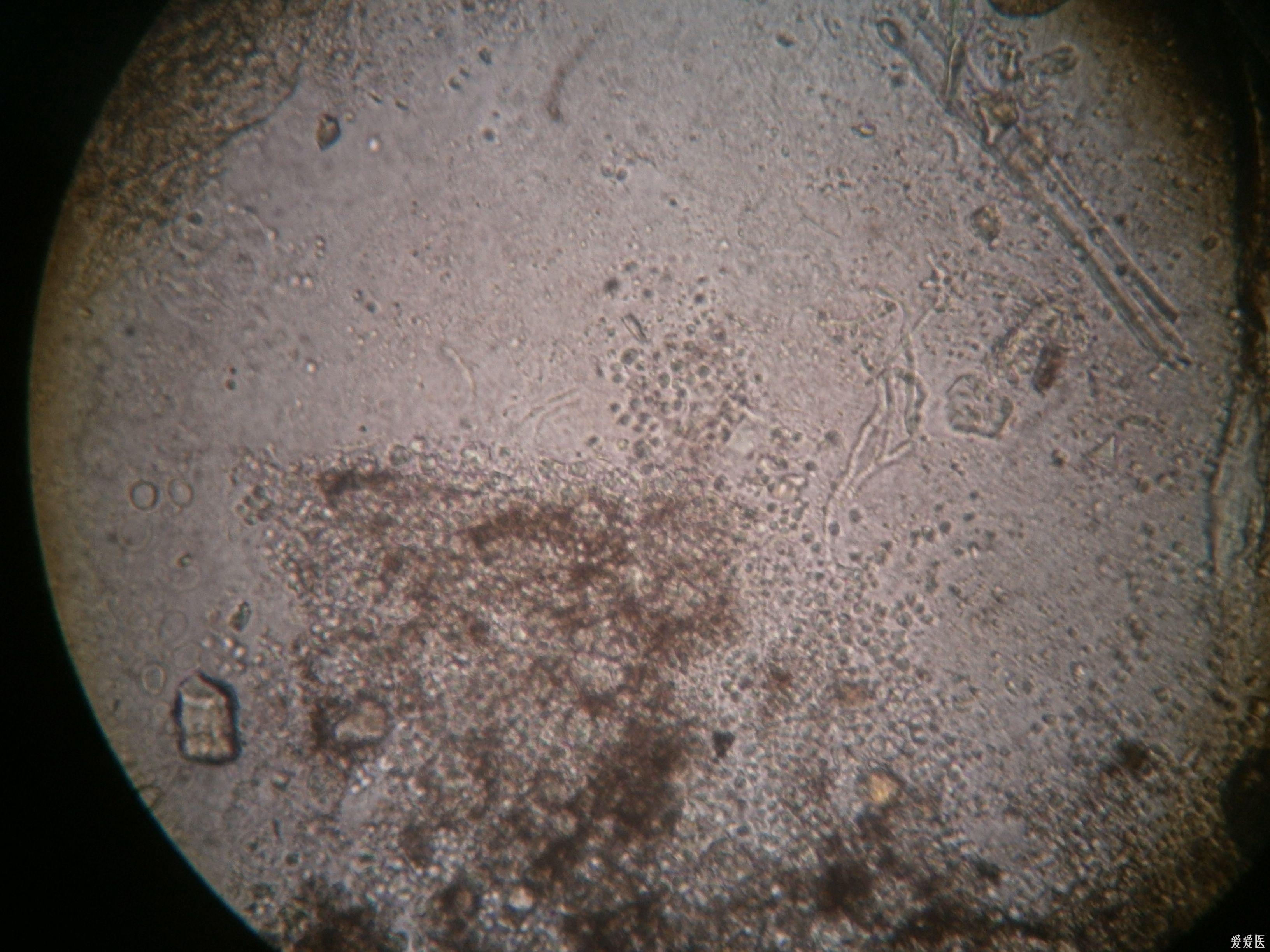 真菌孢子镜下图片图片