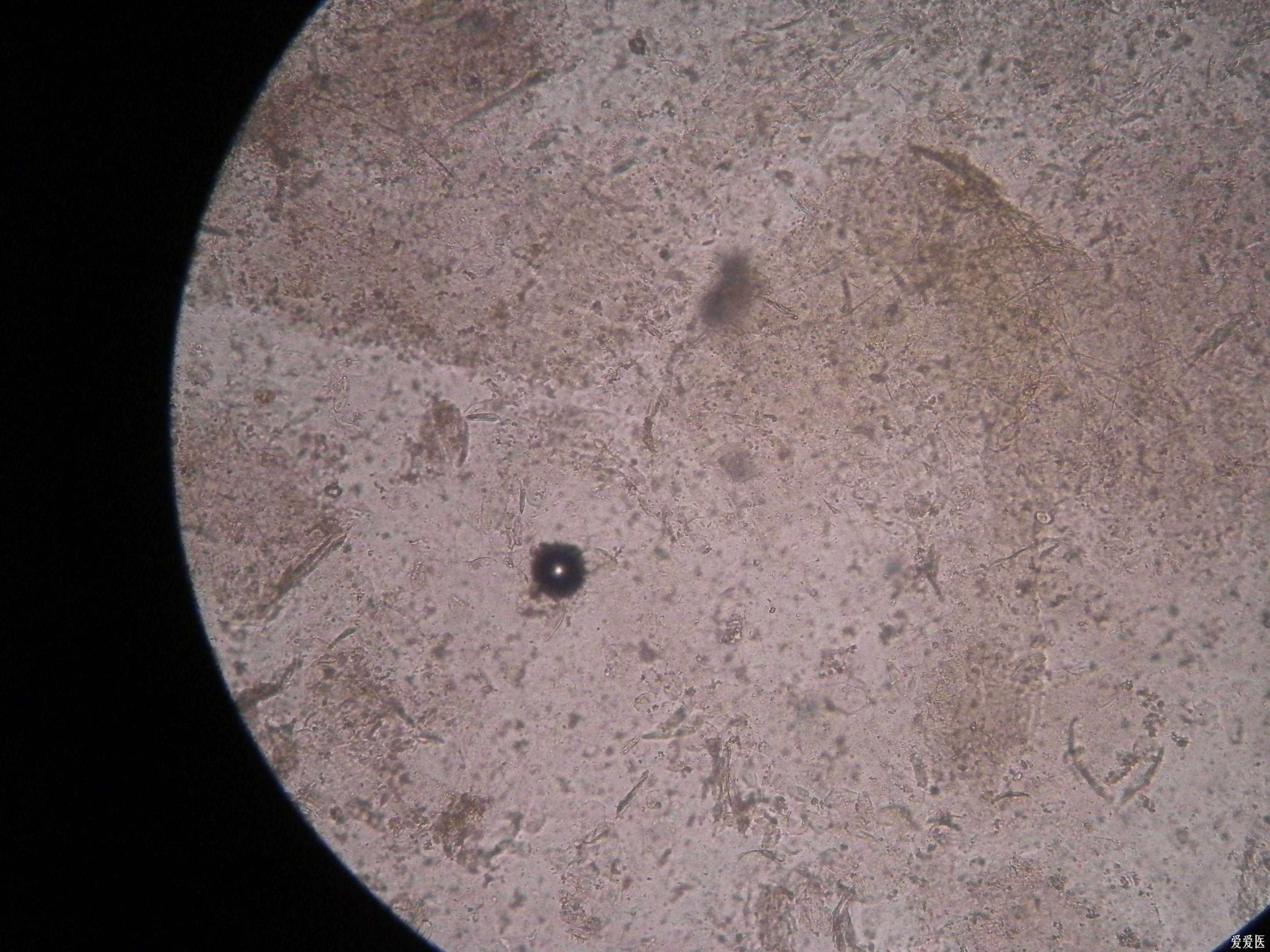 真菌菌丝革兰染色图片
