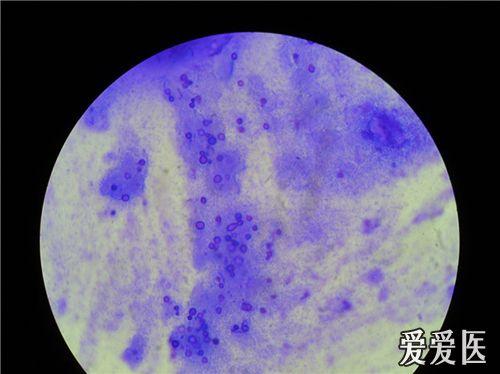 请大家发一些真菌孢子的显微图片以供学习