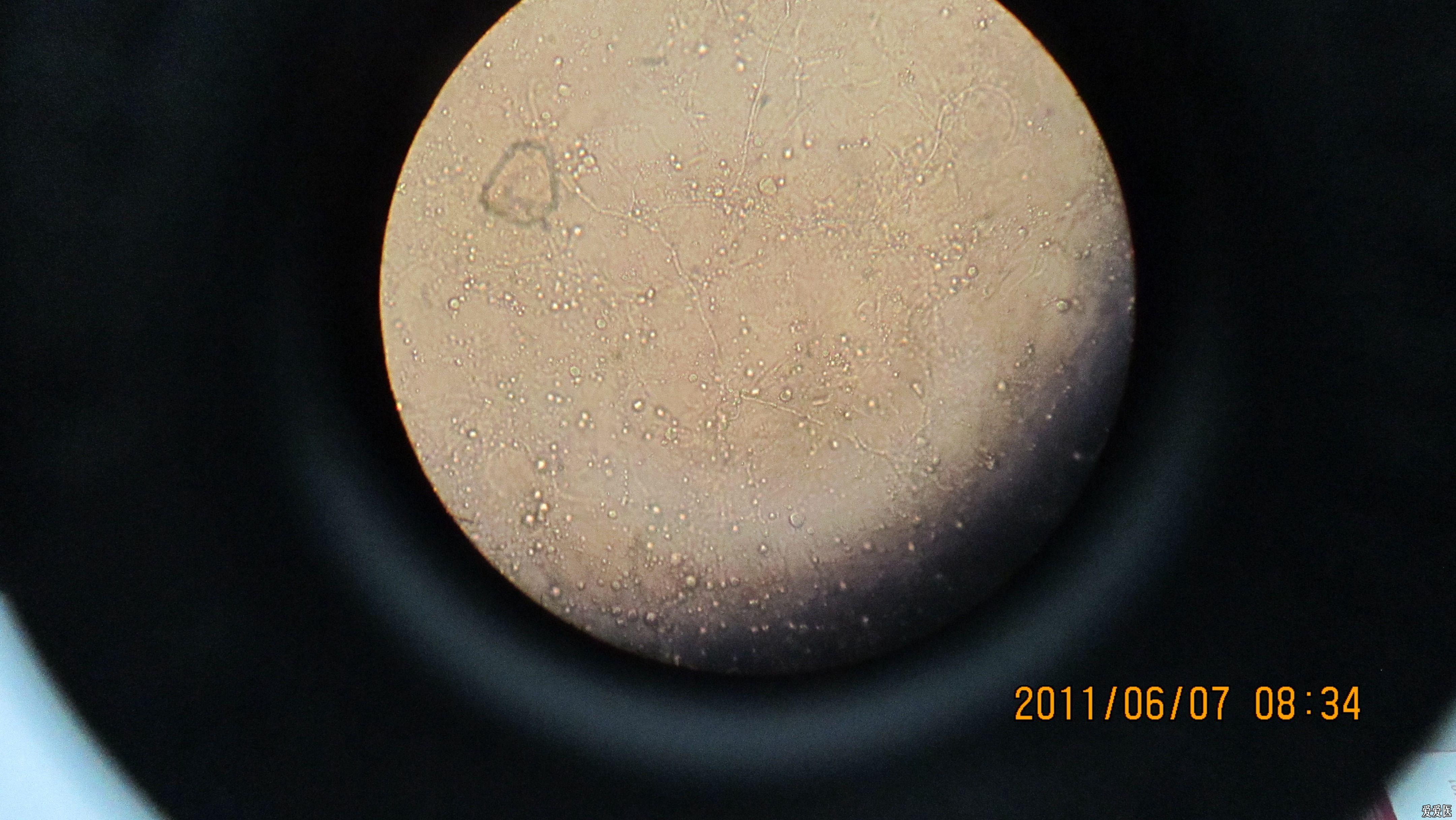 真菌孢子镜下图片图片