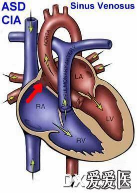 心臟圖片 - 心血管內科討論版 - 愛愛醫醫學論壇