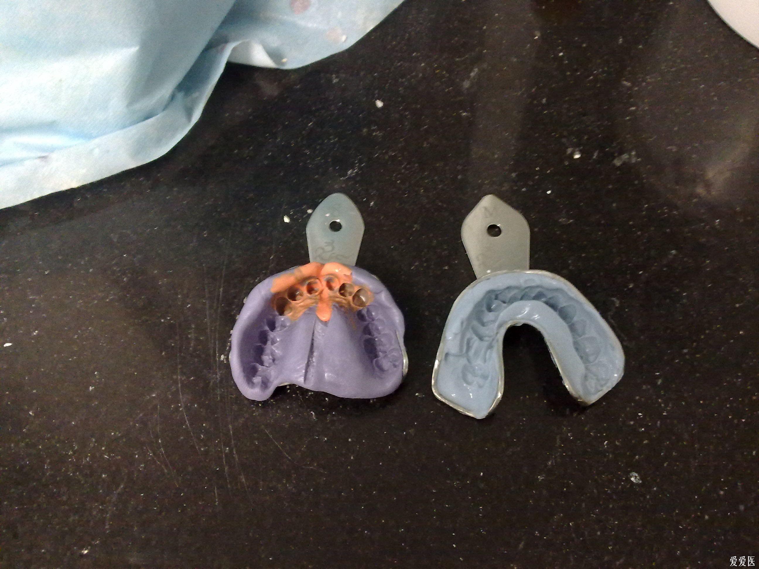 硅橡胶取工作模