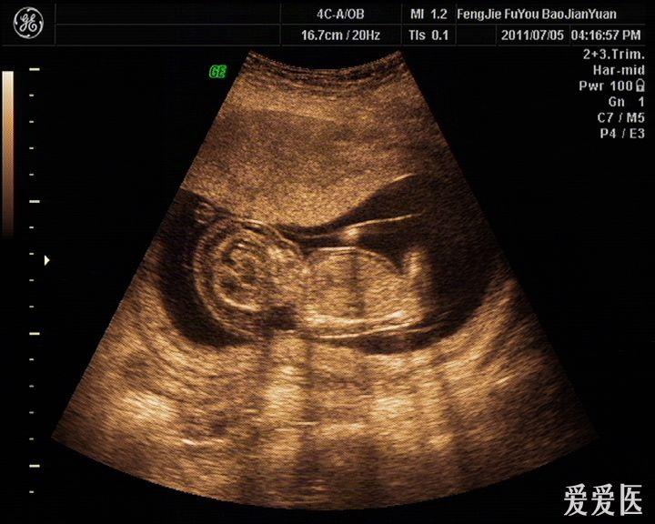 孕妇水囊图片图片