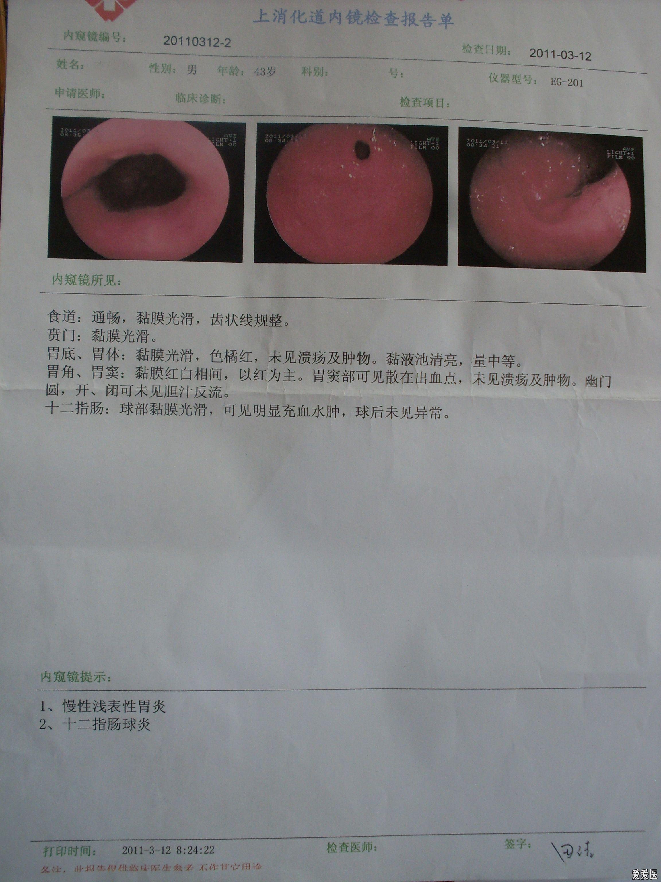 持續性劍突至喉部